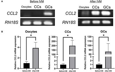 The effect of C–C motif chemokine ligand 2 supplementation on in vitro maturation of porcine cumulus-oocyte complexes and subsequent developmental competence after parthenogenetic activation